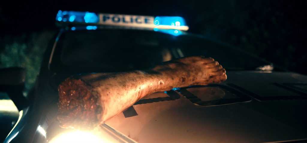 Severed foot on police car